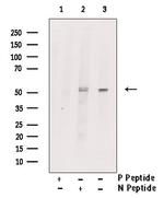 Phospho-RIP3 (Ser316) Antibody in Western Blot (WB)