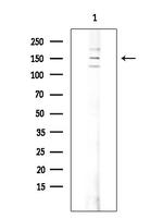 SOS1 Antibody in Western Blot (WB)