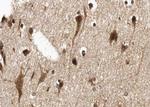 n-Myc Antibody in Immunohistochemistry (Paraffin) (IHC (P))