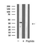 MKP-1 Antibody in Western Blot (WB)