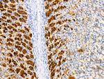 EDG2 Antibody in Immunohistochemistry (Paraffin) (IHC (P))