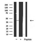 EDG2 Antibody in Western Blot (WB)