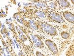 AP2 alpha Antibody in Immunohistochemistry (Paraffin) (IHC (P))