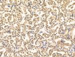 AP2 alpha Antibody in Immunohistochemistry (Paraffin) (IHC (P))