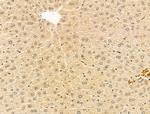 AP2 alpha Antibody in Immunohistochemistry (Paraffin) (IHC (P))