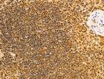 HDAC5 Antibody in Immunohistochemistry (Paraffin) (IHC (P))