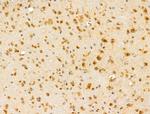 HDAC5 Antibody in Immunohistochemistry (Paraffin) (IHC (P))