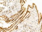 HDAC5 Antibody in Immunohistochemistry (Paraffin) (IHC (P))