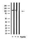 HDAC5 Antibody in Western Blot (WB)