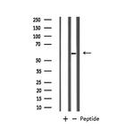 GABRB1 Antibody in Western Blot (WB)