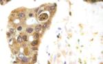 HDAC5 Antibody in Immunohistochemistry (Paraffin) (IHC (P))