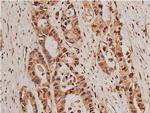 HDAC5 Antibody in Immunohistochemistry (Paraffin) (IHC (P))