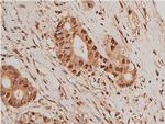 HDAC5 Antibody in Immunohistochemistry (Paraffin) (IHC (P))