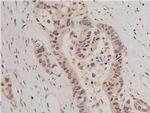 HDAC5 Antibody in Immunohistochemistry (Paraffin) (IHC (P))