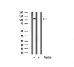 HDAC5 Antibody in Western Blot (WB)