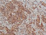 TIMP2 Antibody in Immunohistochemistry (Paraffin) (IHC (P))