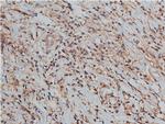 TIMP2 Antibody in Immunohistochemistry (Paraffin) (IHC (P))