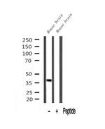 Nudel Antibody in Western Blot (WB)