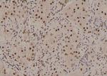 Phospho-CTGF (Ser118) Antibody in Immunohistochemistry (Paraffin) (IHC (P))