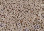 Phospho-CTGF (Ser118) Antibody in Immunohistochemistry (Paraffin) (IHC (P))