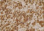 Phospho-KISS1R (Ser368) Antibody in Immunohistochemistry (Paraffin) (IHC (P))