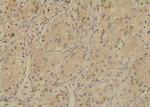 Phospho-SGLT1 (Ser335) Antibody in Immunohistochemistry (Paraffin) (IHC (P))