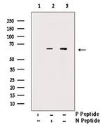 Phospho-SGLT1 (Ser335) Antibody in Western Blot (WB)