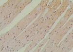 Phospho-SETD2 (Ser532) Antibody in Immunohistochemistry (Paraffin) (IHC (P))