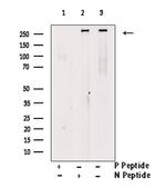 Phospho-SETD2 (Ser532) Antibody in Western Blot (WB)