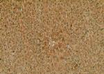 Phospho-FABP1 (Ser11) Antibody in Immunohistochemistry (Paraffin) (IHC (P))