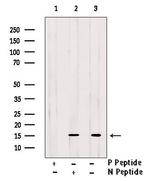 Phospho-FABP1 (Ser11) Antibody in Western Blot (WB)