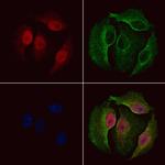 Phospho-NEK2 (Ser171) Antibody in Immunocytochemistry (ICC/IF)