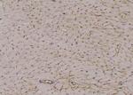 Phospho-NEK2 (Ser171) Antibody in Immunohistochemistry (Paraffin) (IHC (P))