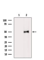 Phospho-FKBP4 (Tyr220) Antibody in Western Blot (WB)