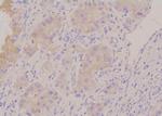 Phospho-HPRT1 (Ser110) Antibody in Immunohistochemistry (Paraffin) (IHC (P))