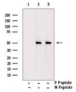 Phospho-Caspase 2 Precursor (Ser340) Antibody in Western Blot (WB)