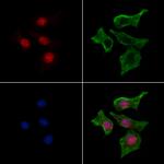 Phospho-SP7 (Thr319) Antibody in Immunocytochemistry (ICC/IF)