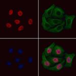 Phospho-PAX7 (Ser203) Antibody in Immunocytochemistry (ICC/IF)