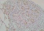 Phospho-PAX7 (Ser203) Antibody in Immunohistochemistry (Paraffin) (IHC (P))