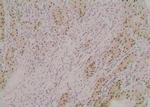 Phospho-ATG3 (Tyr18) Antibody in Immunohistochemistry (Paraffin) (IHC (P))