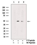 Phospho-SMYD2 (Ser283) Antibody in Western Blot (WB)