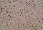 Phospho-Annexin A2 (Tyr238) Antibody in Immunohistochemistry (Paraffin) (IHC (P))