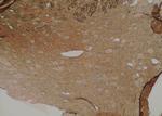 Phospho-DNM1L (Ser529) Antibody in Immunohistochemistry (Paraffin) (IHC (P))