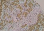 Phospho-PDCD5 (Ser119) Antibody in Immunohistochemistry (Paraffin) (IHC (P))