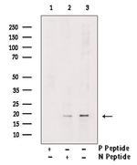 Phospho-PDCD5 (Ser119) Antibody in Western Blot (WB)