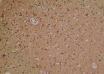 Phospho-MYPT1 (Ser299) Antibody in Immunohistochemistry (Paraffin) (IHC (P))