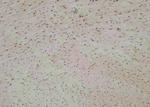 Phospho-MYPT1 (Ser299) Antibody in Immunohistochemistry (Paraffin) (IHC (P))