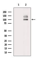 Phospho-MUSK (Tyr755) Antibody in Western Blot (WB)