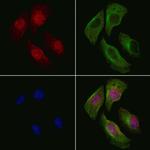 Phospho-FANCA (Ser1449) Antibody in Immunocytochemistry (ICC/IF)