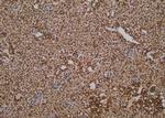 Phospho-FANCA (Ser1449) Antibody in Immunohistochemistry (Paraffin) (IHC (P))